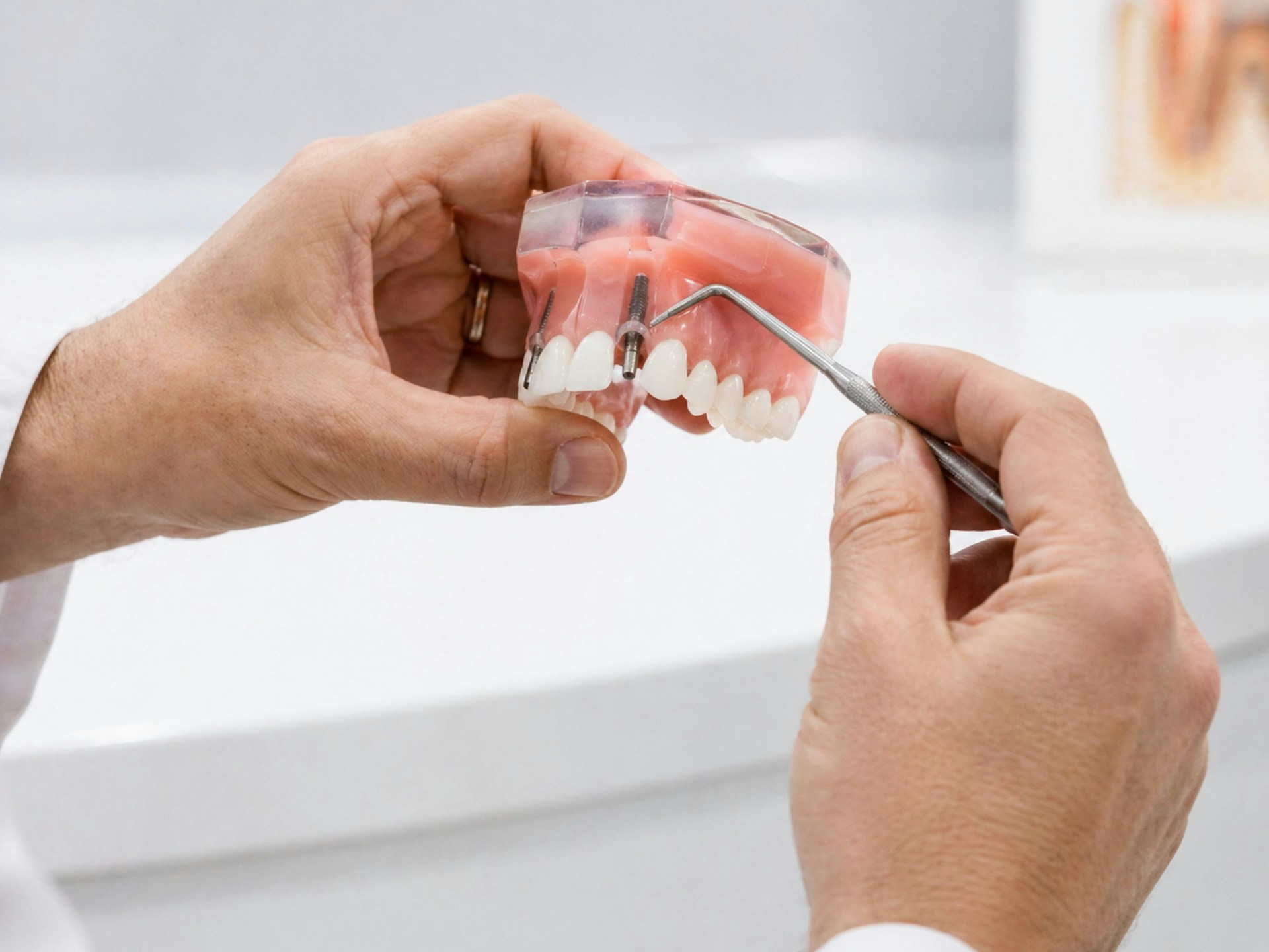 Dentist discussing dental implant treatment with a patient